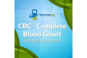 High Blood Chloride - Causes, Symptoms, and Treatment Options