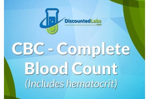 How to Read and Understand  the CBC Blood Test Panel?