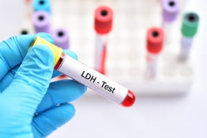 LDH Blood Test: What is it Used For? - Discounted Labs