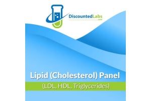 How To Increase HDL- Top Tips and Tricks That Work