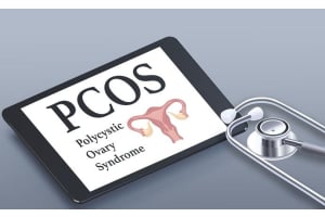 PCOS Symptoms Quiz: Discover if You Have It
