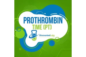 Prothrombin Time PT Test - What It Is and Why You Might Need One