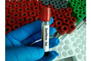 Best TB Test- Quantiferon Gold- An IGRA Test