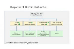 Thyroid Lab Tests Types and Controversies
