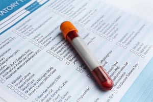 Factors that Can Affect the Accuracy of Your Blood Test Results