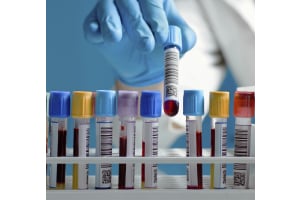 Factors that Can Affect the Accuracy of Your Blood Test Results