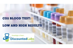 Understanding and Managing Your CO2 Blood Test Results