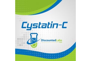 Is the Cystatin C Test Better than Creatinine for Muscular Men?