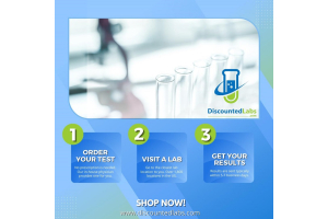 MCHC Blood Test: What is It and How to Interpret Results