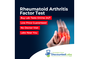 Understanding Rheumatoid Arthritis Blood Test