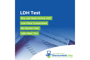 Understanding the LDH Blood Test: Importance and Preparation