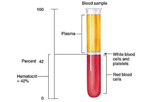  Managing High Hematocrit Levels Induced by Testosterone Replacement Therapy