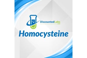 Homocysteine Blood Test - Symptoms, Complications, and Treatment