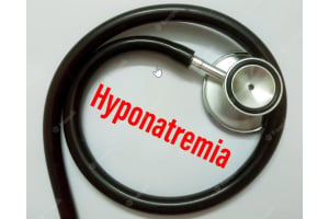Understanding Hyponatremia (Low Sodium):  Causes, Symptoms, Diagnosis, and Treatment
