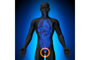 BPH Symptoms and Treatments