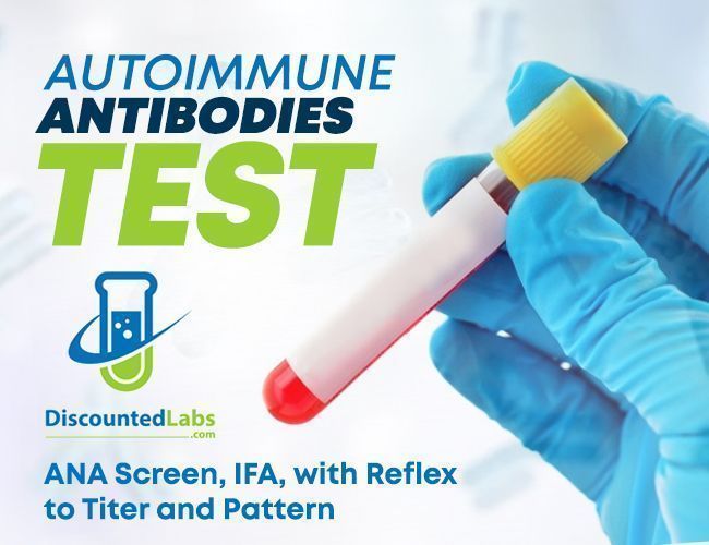 Autoimmune Antibodies ANA Screen IFA With Reflex To Titer And Pattern autoimmune-antibodies-ana-screen-ifa-with-reflex-to-titer-and-pattern