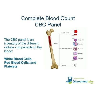 CBC - Complete Blood Count