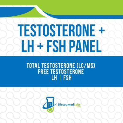 Testosterone LH FSH Lab Tests