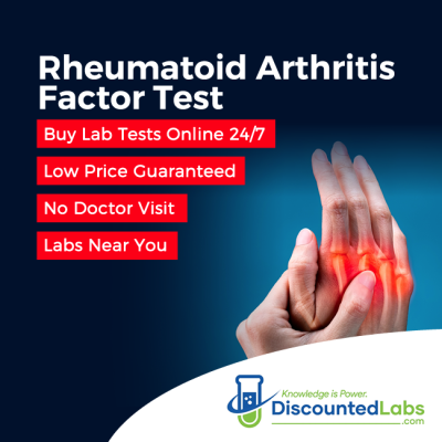 Rheumatoid Arthritis Factor Test discounted labs