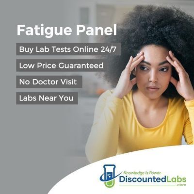 Fatigue tests