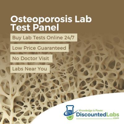 osteoporosis lab tests