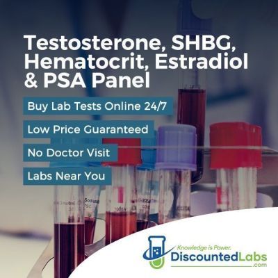 Lab Tests for testosterone, SHBG, hematocrit, estradiol and PSA