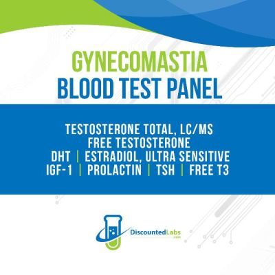 Gynecomastia Lab Test Panel
