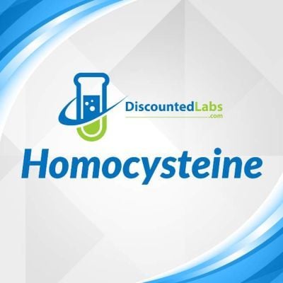 homocysteine test for inflammation 