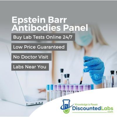mononucleosis test epstein barr discounted labs