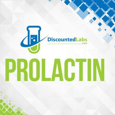 Prolactin lab blood test