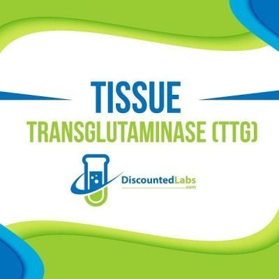 TTG tissue transglutaminase test

