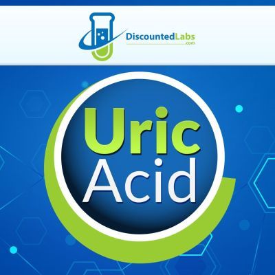 Uric Acid (Serum)