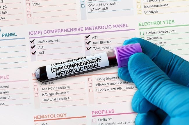 high chloride blood level