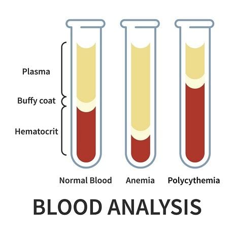 testosterone TRT increased hematocrit