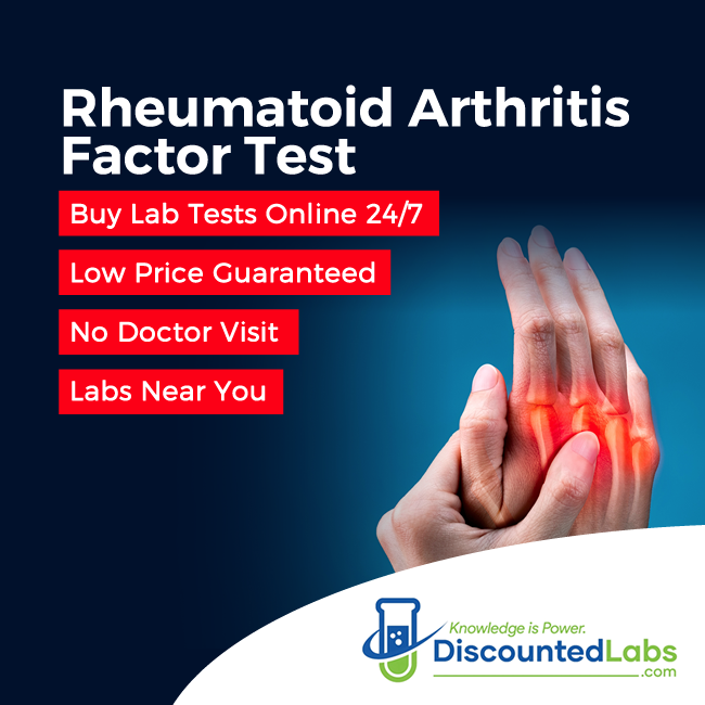 Understanding Rheumatoid Arthritis Blood Test