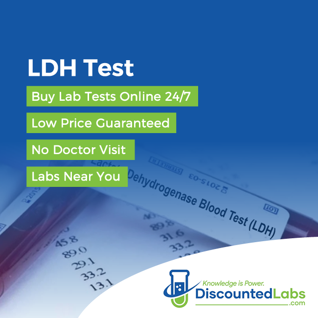 LDH blood test