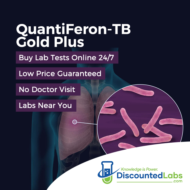 affordable quantiferon tb blood test near me
