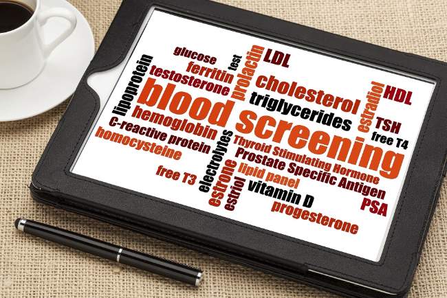 how to prepare for lab blood tests