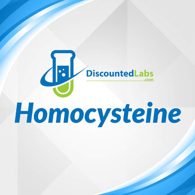 homocysteine test