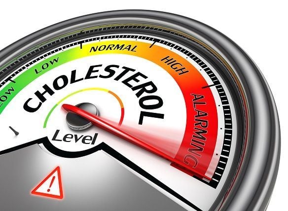 lipid cholesterol  panel 