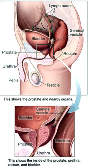 testosterone does not increase prostate cancer