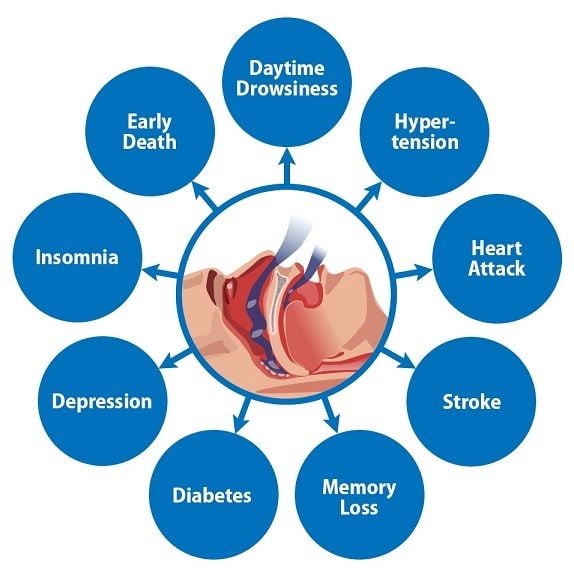 sleep apnea and testosterone