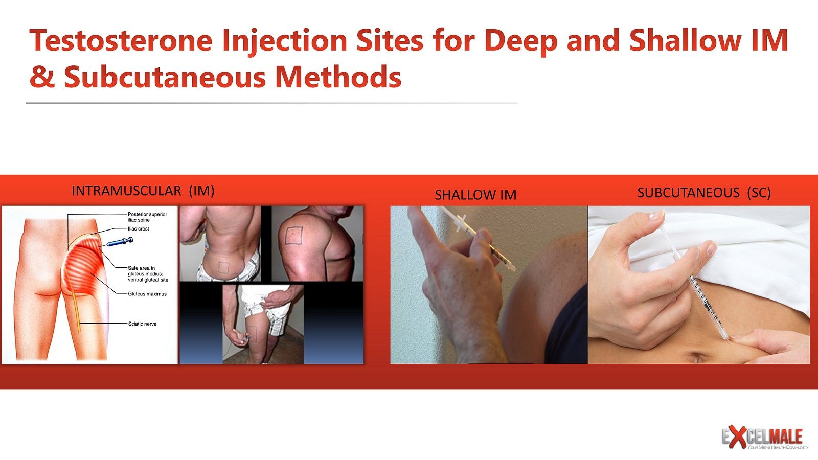 subcutaneous versus intramuscular IM testosterone injections