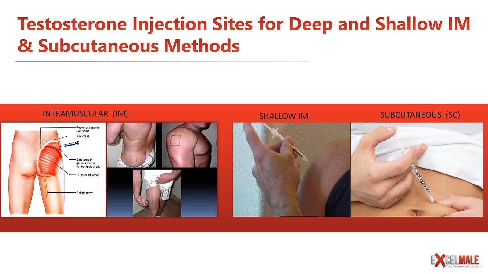 An error occurred while injecting extreme injector rust фото 17